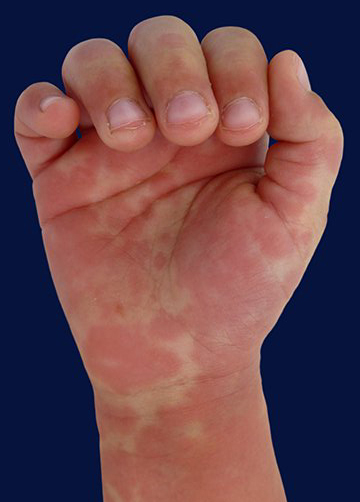 Източник: https://rcni.com